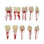 Endo acrylic teeth